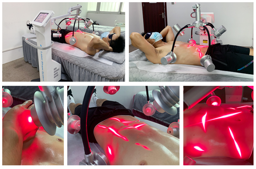 Laser and Light Therapies - Oakdale, MN - Northern Lights