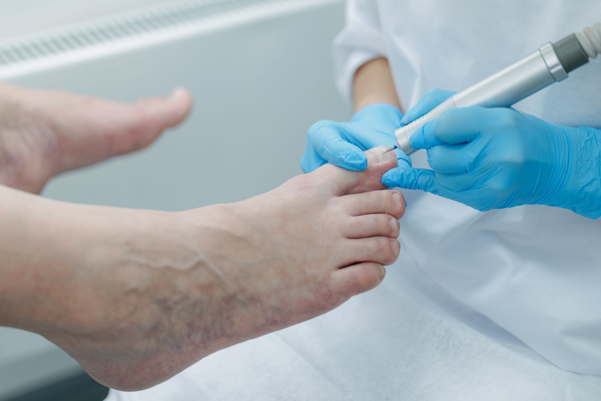 A doctor is treating a patient’s toenail.