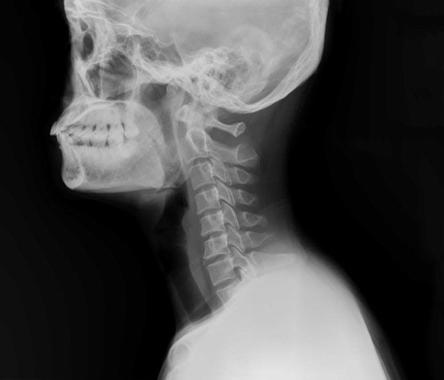 X-ray — Wilmington, NC — Wilmington Ear Nose & Throat