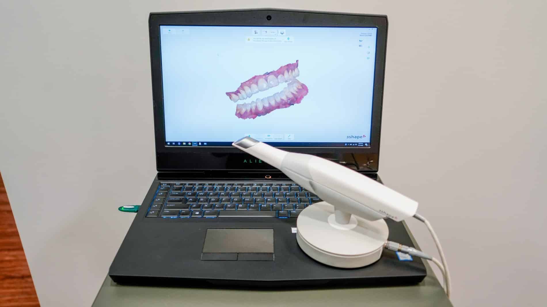 A laptop computer with a 3d scanner sitting on top of it.