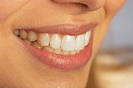 A close up of a woman 's smile with white teeth.