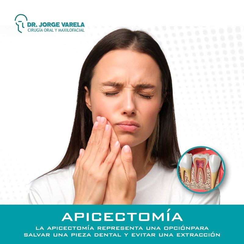 JORGE ALBERTO FERNANDO VARELA LÓPEZ-dolor facial