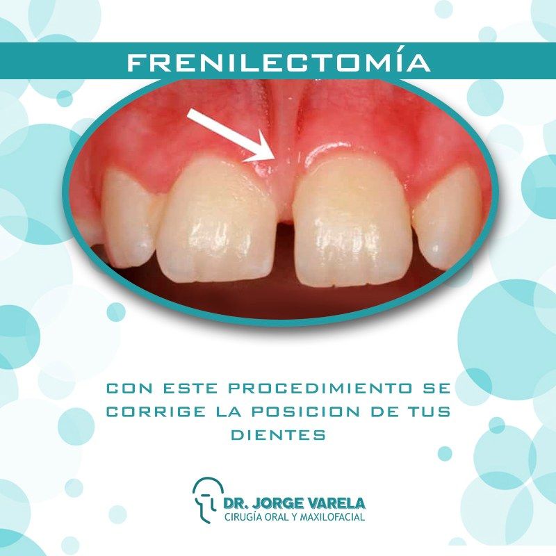 JORGE ALBERTO FERNANDO VARELA LÓPEZ-dolor facial