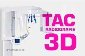 Radiologia Odontoiatrica 3D