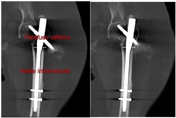 Tomografia: o que é, para que serve e como é feita