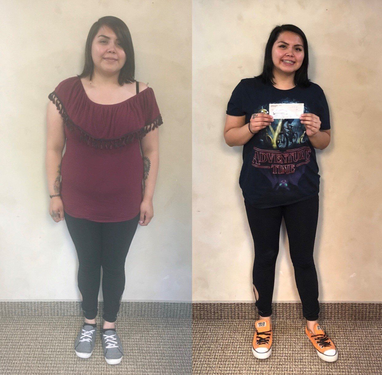 Idaho Falls, ID — Before and After Image of a Stomach in  Idaho Falls, ID