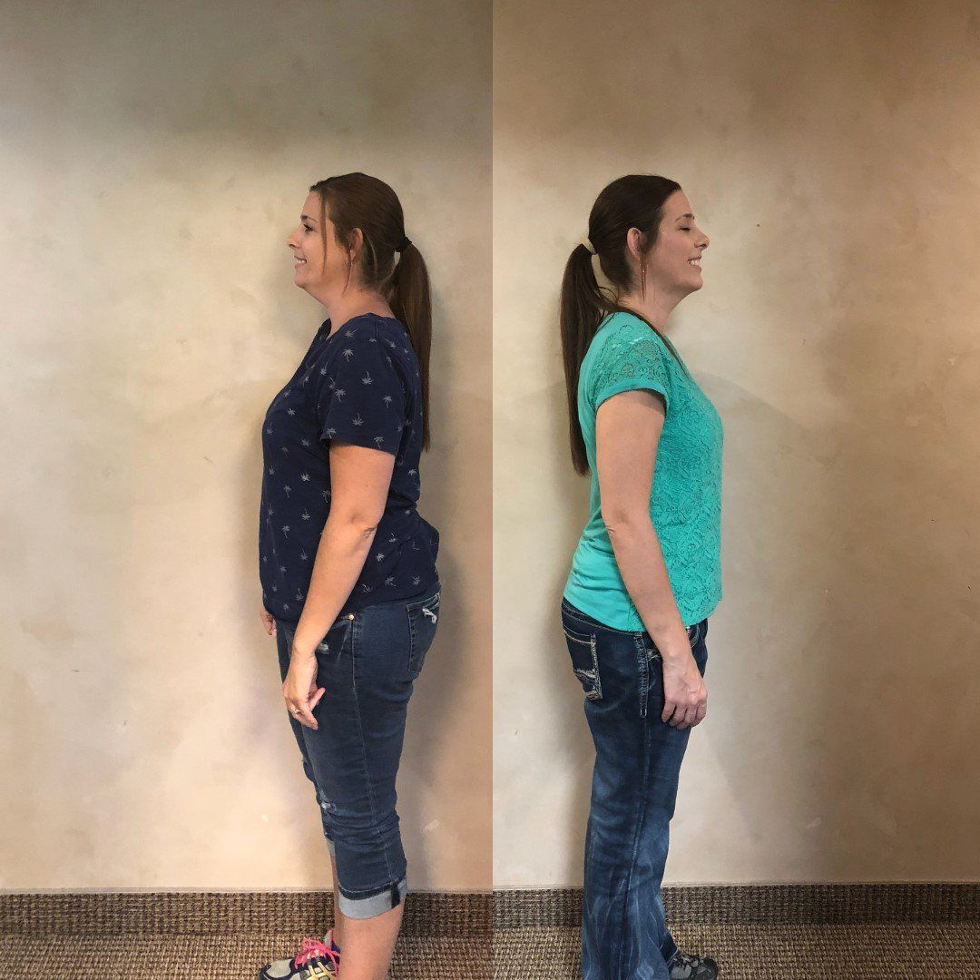 After A Diet — Woman's body before and after a diet in  Idaho Falls, ID