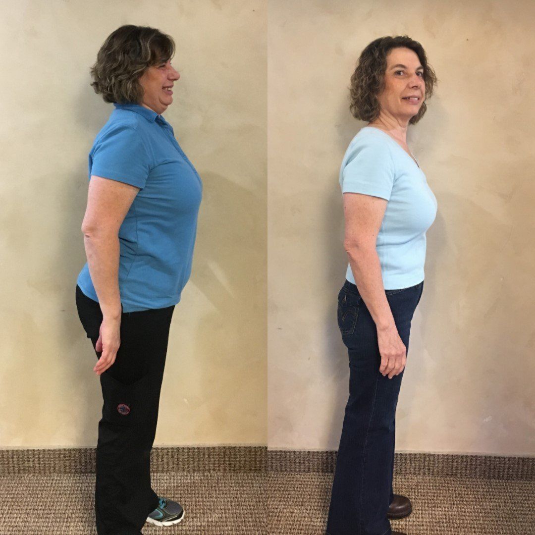 Weight Loss — Woman Posing Before and After Successful Diet in  Idaho Falls, ID
