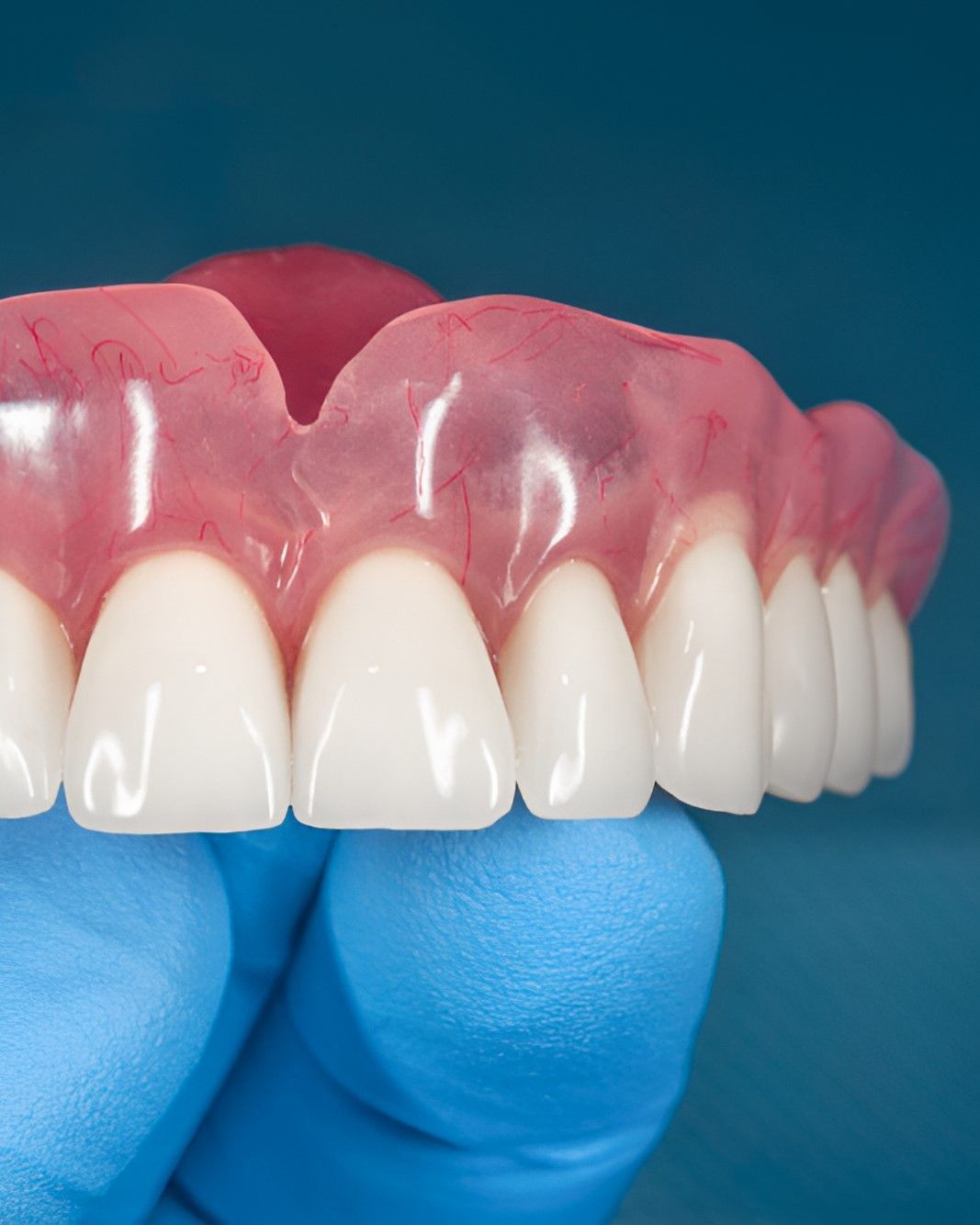 A Person Wearing Blue Gloves is Holding a Denture in Their Hand — Yeppoon Denture Clinic in Taranganba, QLD