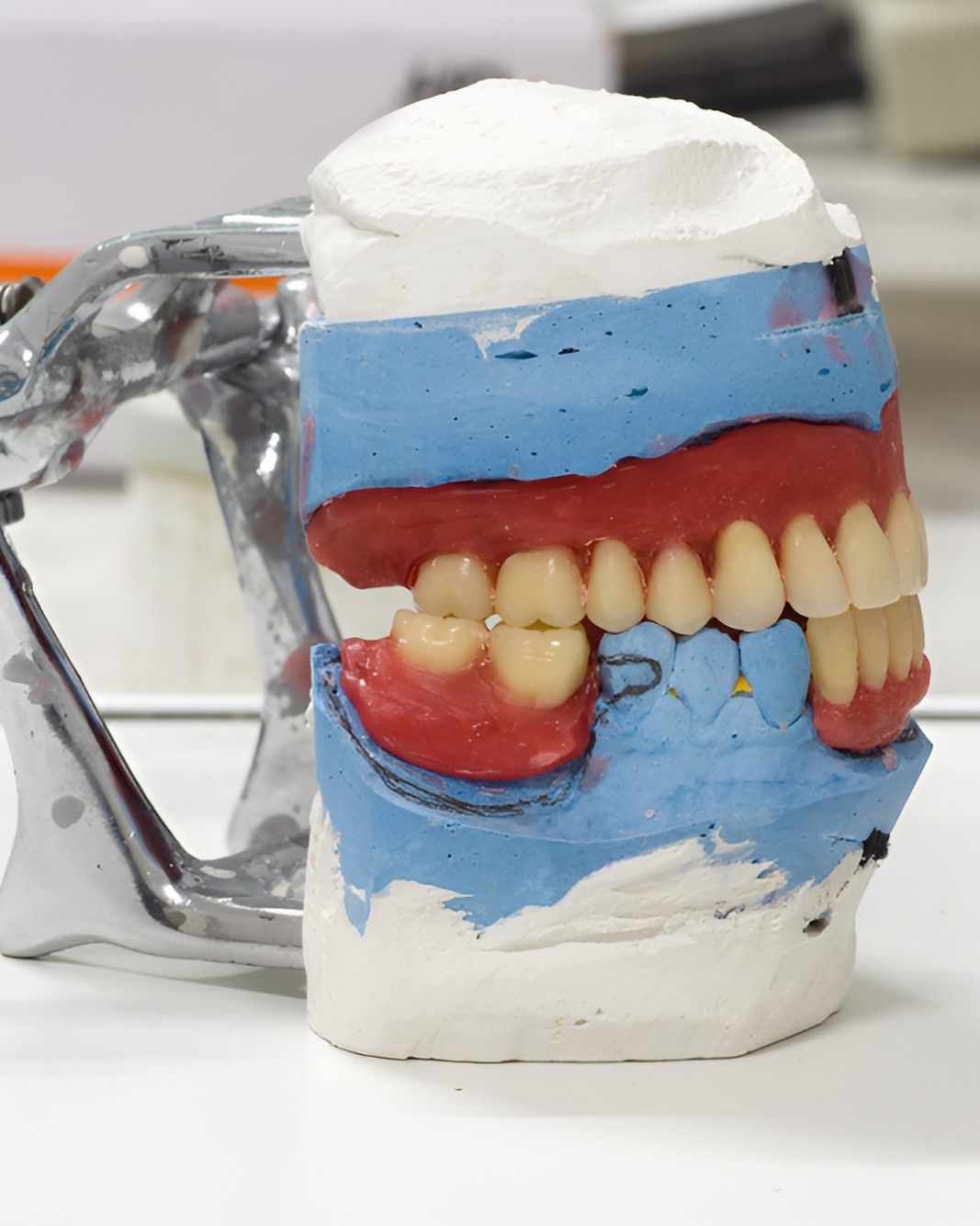 A Model of a Person's Teeth is Sitting on a Table — Yeppoon Denture Clinic in Taranganba, QLD