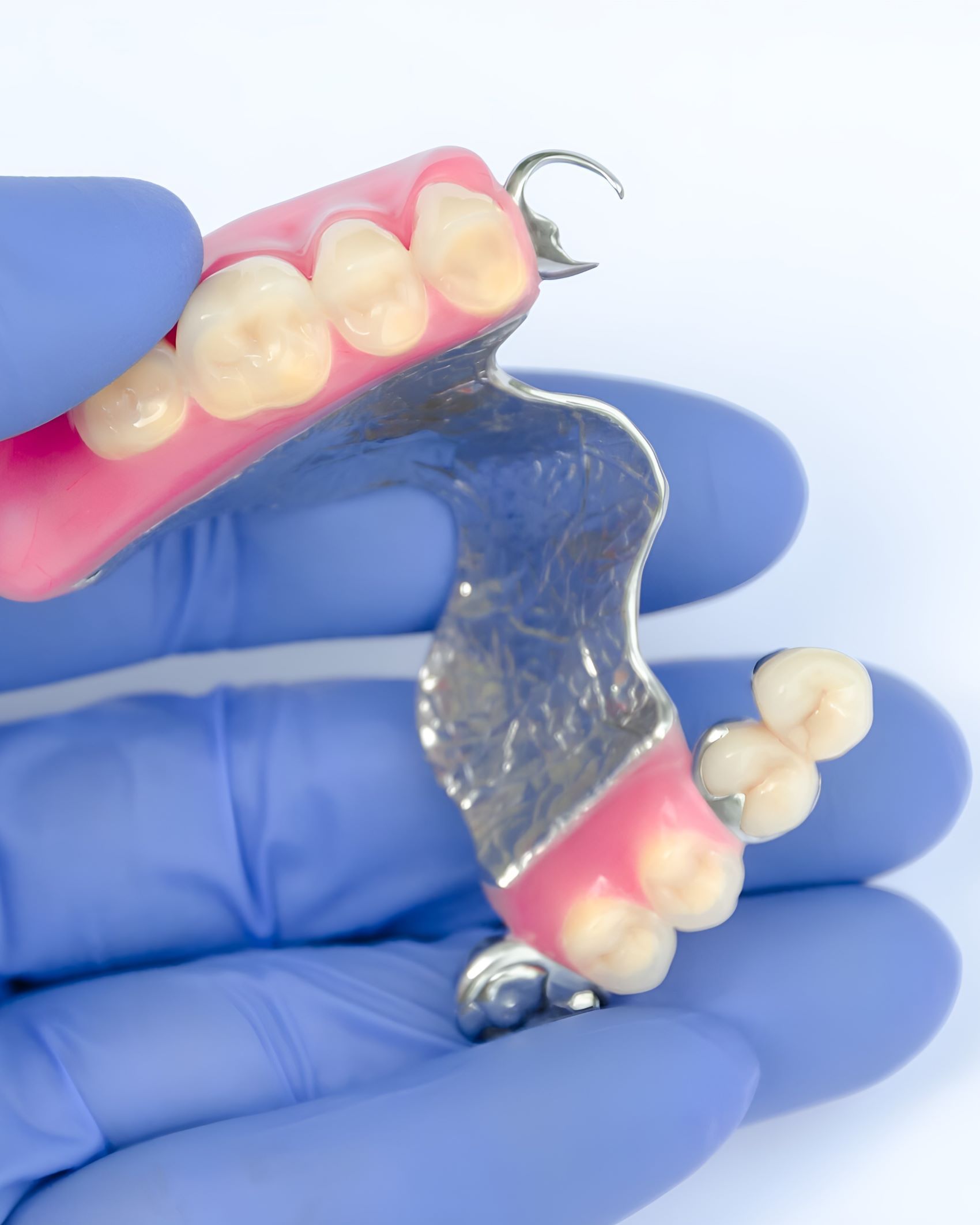 A Person Wearing Blue Gloves is Holding a Denture in Their Hand — Yeppoon Denture Clinic in Taranganba, QLD