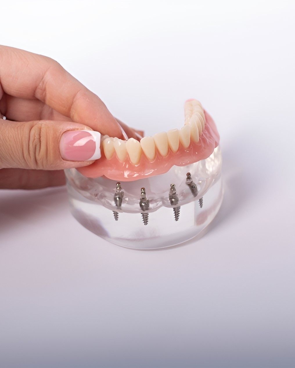 A Woman's Hand is Holding a Model of a Denture — Yeppoon Denture Clinic in Taranganba, QLD