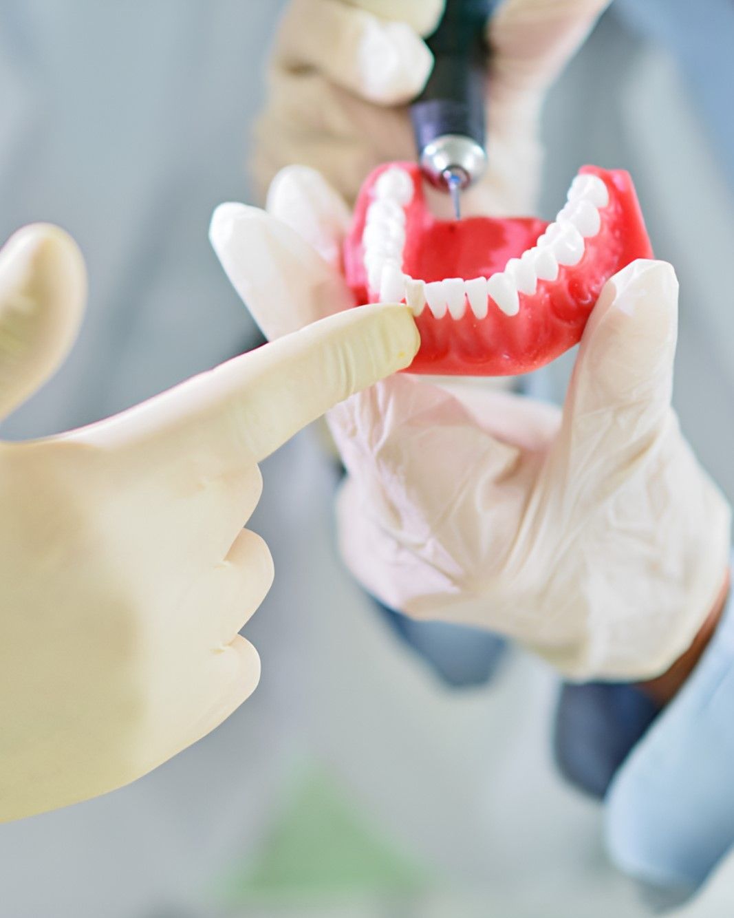 A Dentist is Holding a Model of a Person's Teeth — Yeppoon Denture Clinic in Rockhampton, QLD