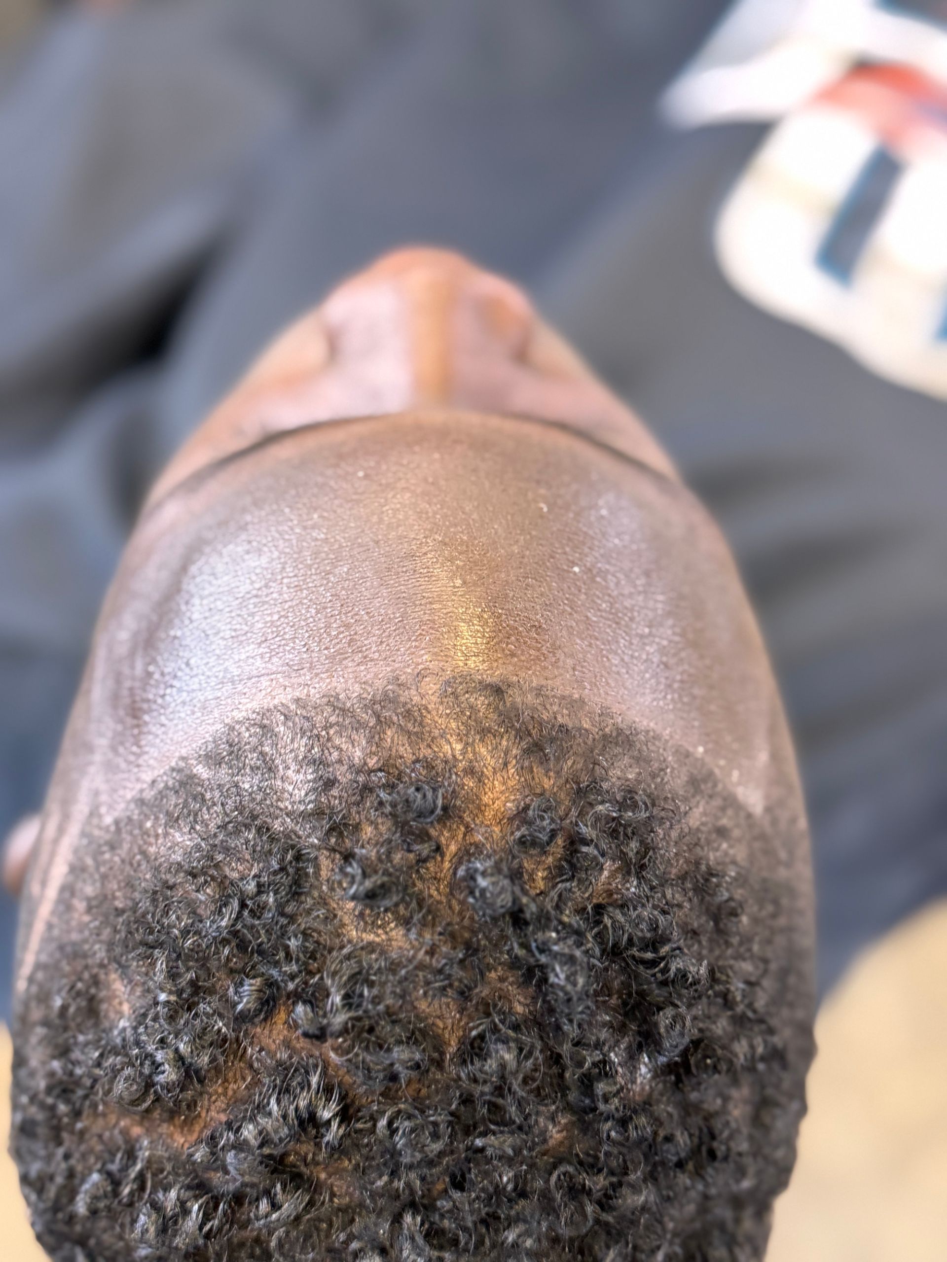 A close up of a person 's head with a shoe in the background