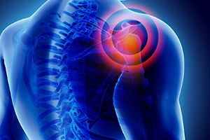   Mindful Yoga for Chronic Pain Stacey Madden