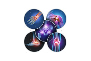 Yoga for Arthritis