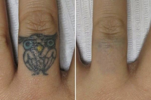 A before and after picture of an owl tattoo on a person 's finger.