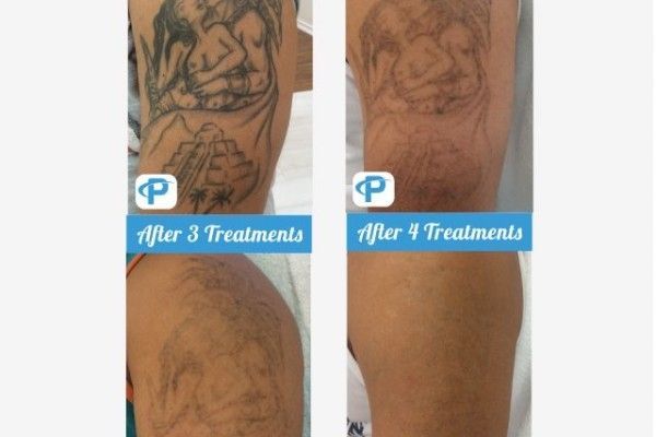 A before and after picture of a tattoo on a person 's arm.