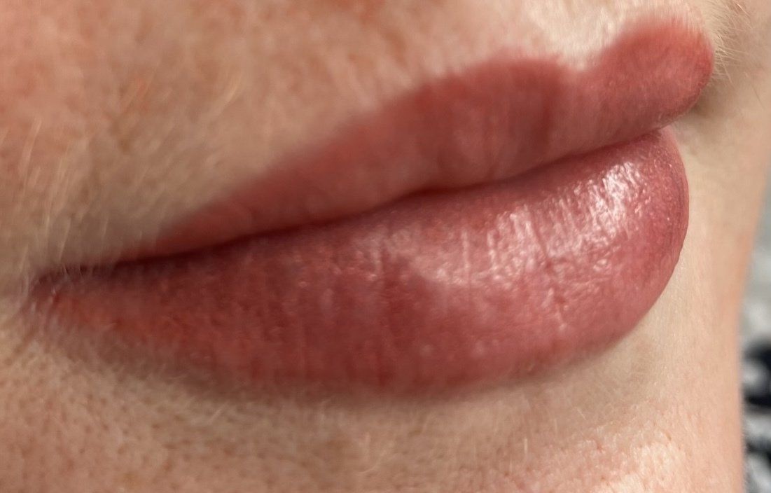 waterloo lips