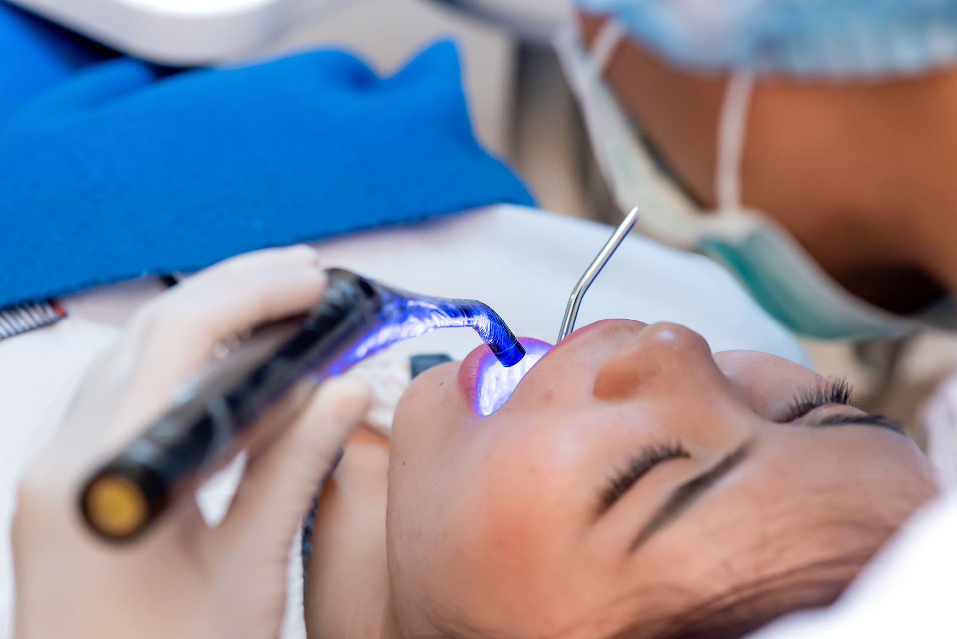 Dentist using a curing light on a patient's filled tooth in a dental office.