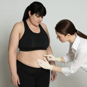 planning surgical weight loss