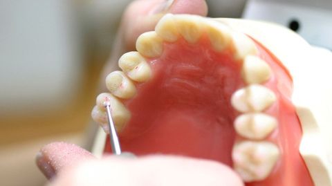 Technician polishing dentures close up elevated view