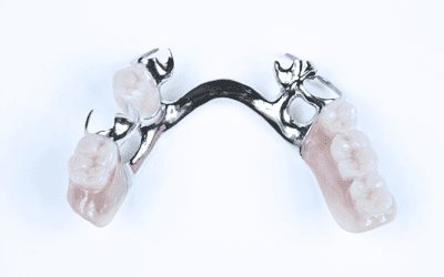 metal alloy dentures
