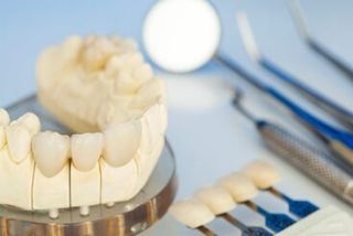 Dental Bridges — Teeth Care in Bridgewater, MA