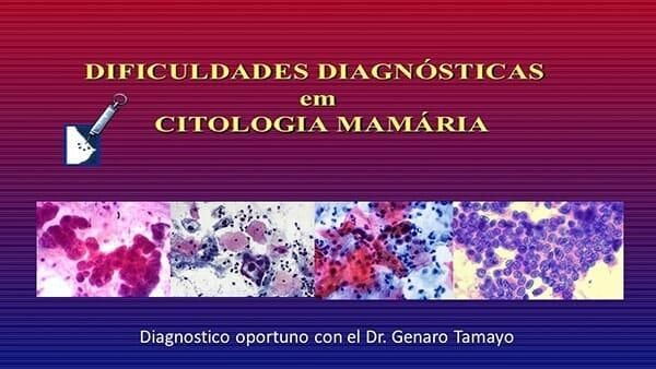 CLÍNICA DE PATOLOGÍA MAMARIA
