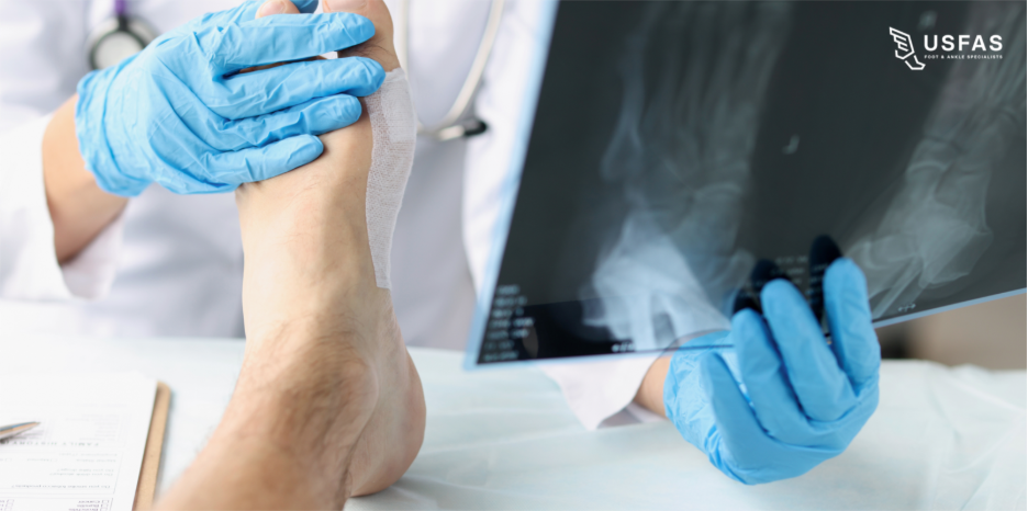 Why early foot care matters
