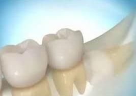 DR. ROBERTO SILVA RIVERA – Cirugía de terceros molares