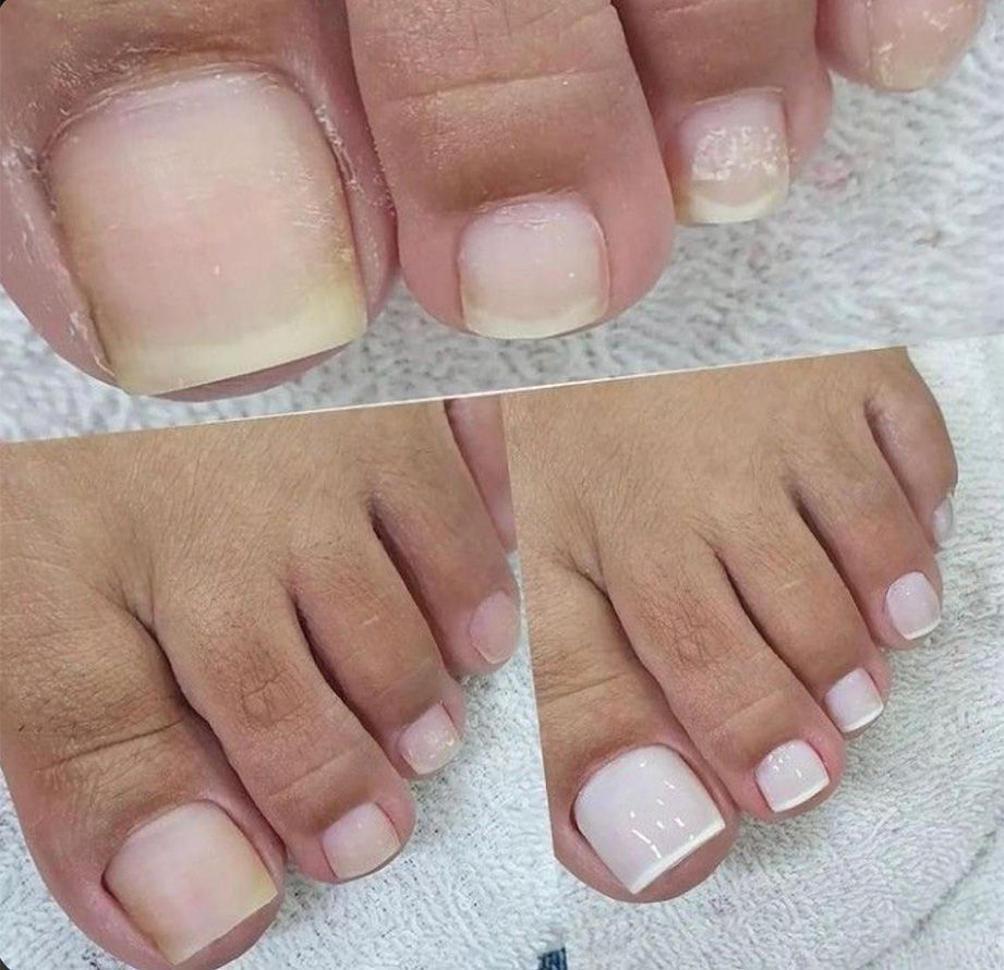 JUDITH TORRES TÉCNICO EN PODOLOGÍA