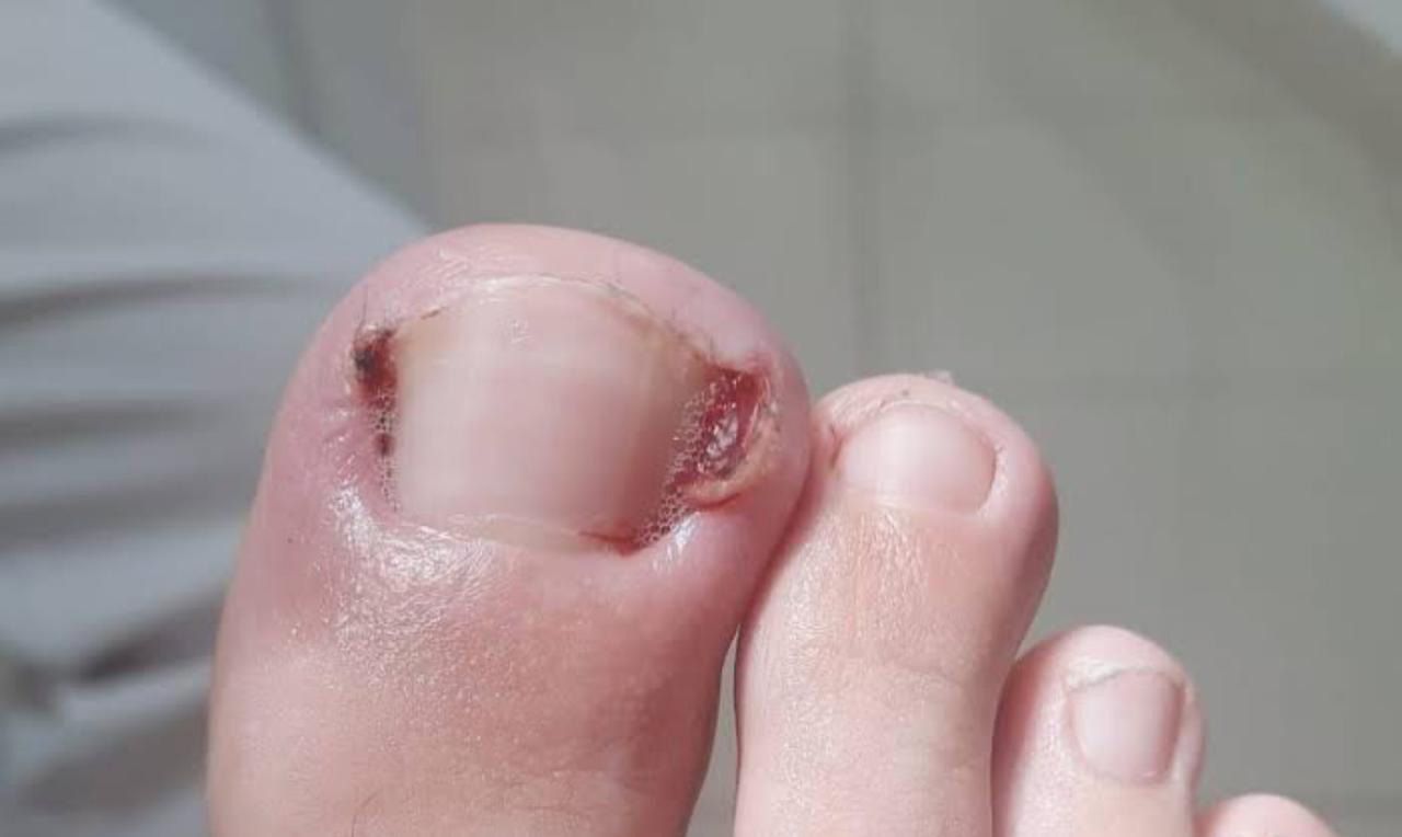 JUDITH TORRES TÉCNICO EN PODOLOGÍA