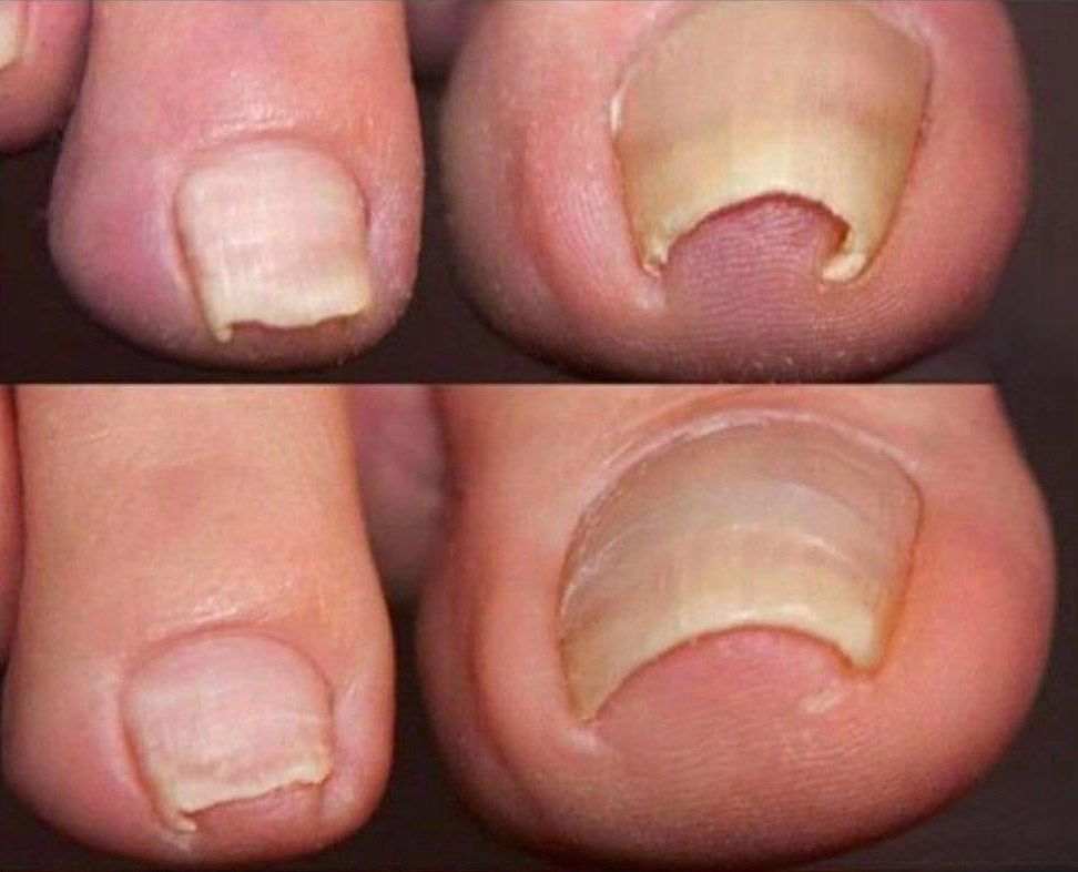 JUDITH TORRES TÉCNICO EN PODOLOGÍA