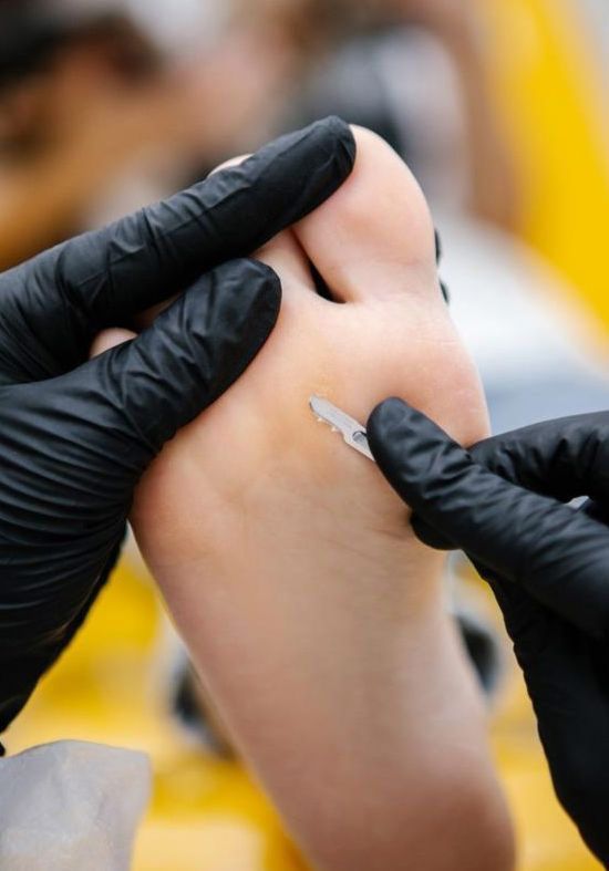 JUDITH TORRES TÉCNICO EN PODOLOGÍA