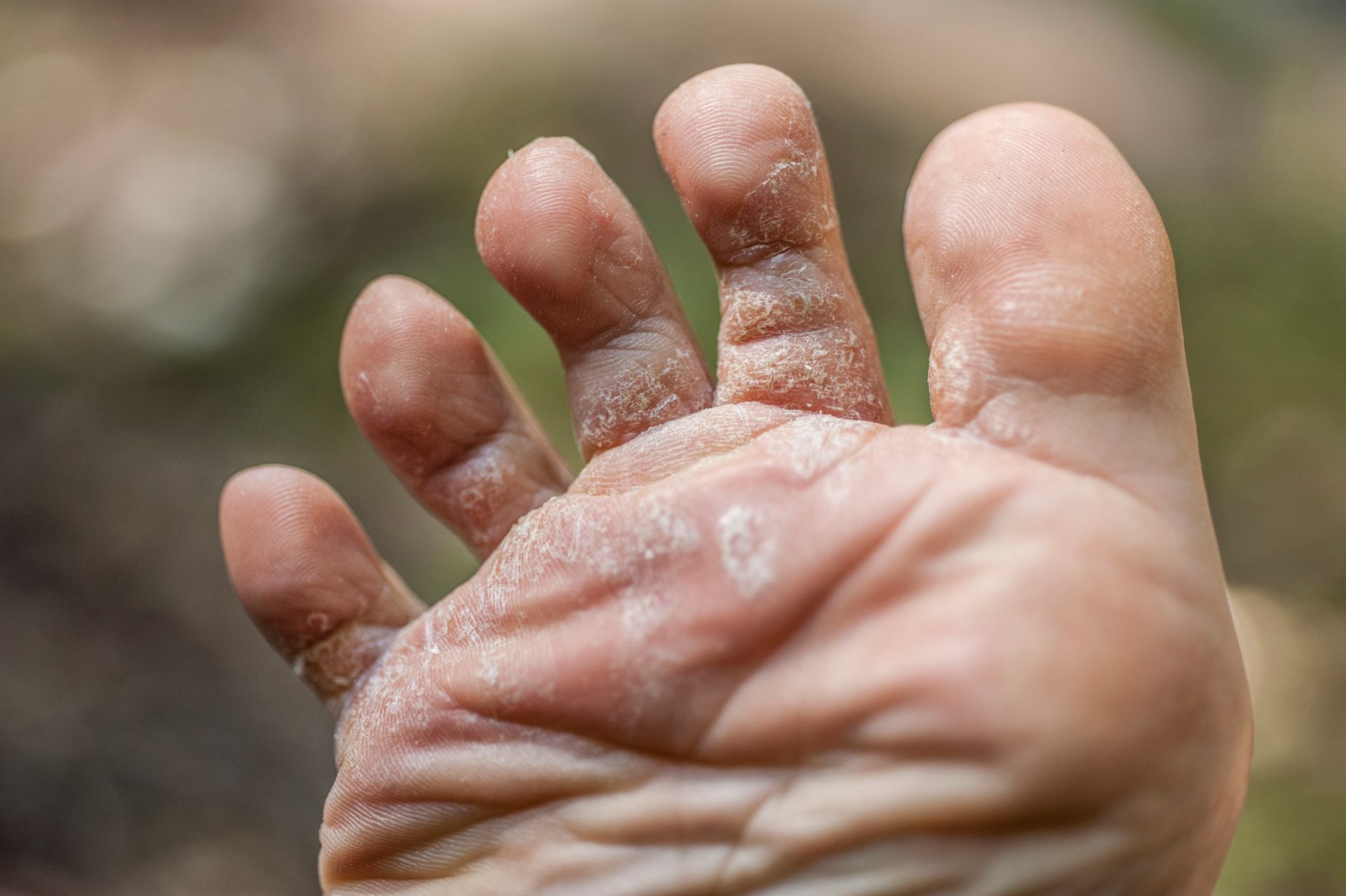 A close up of a person 's foot with a bandage on it.