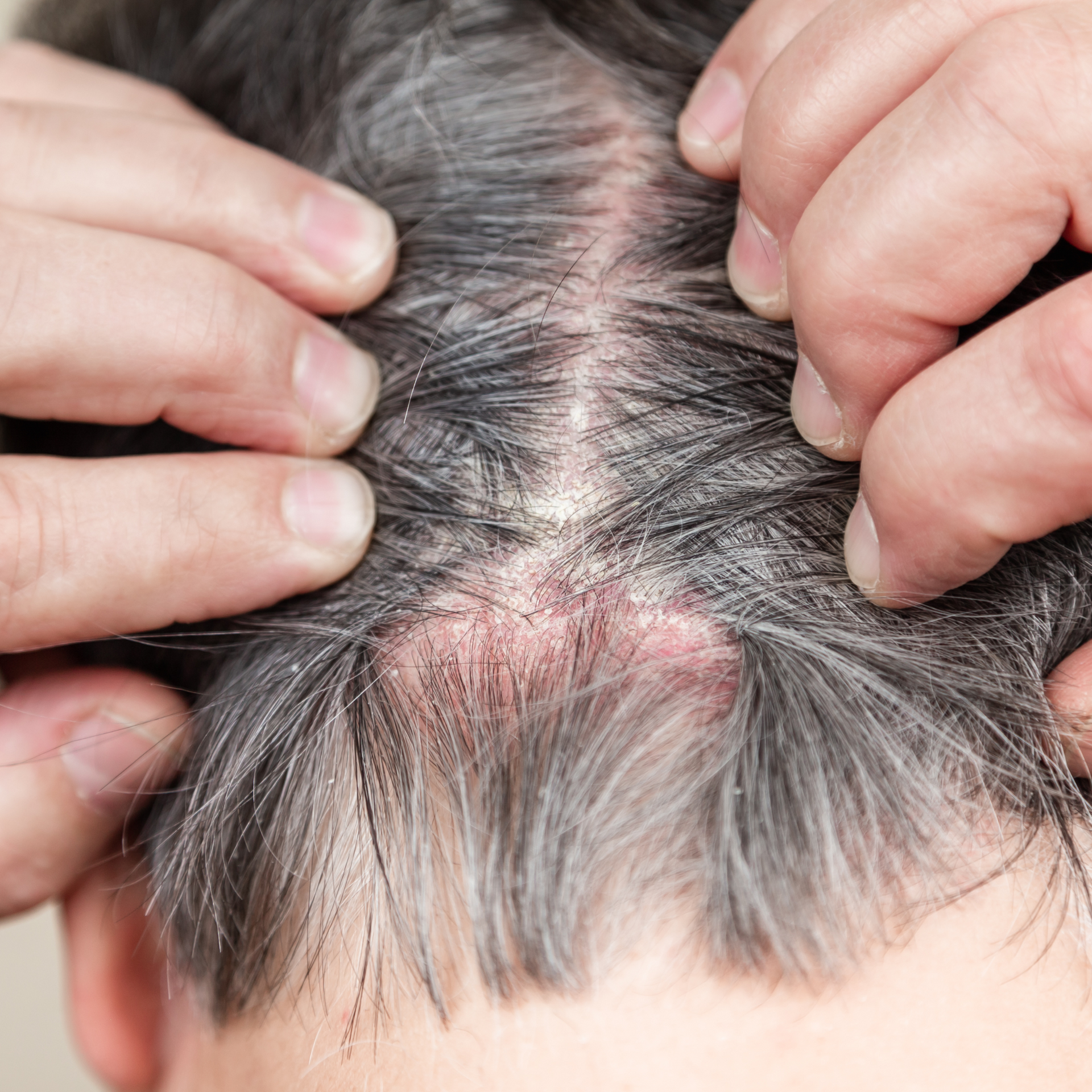 A close up of a person scratching their head