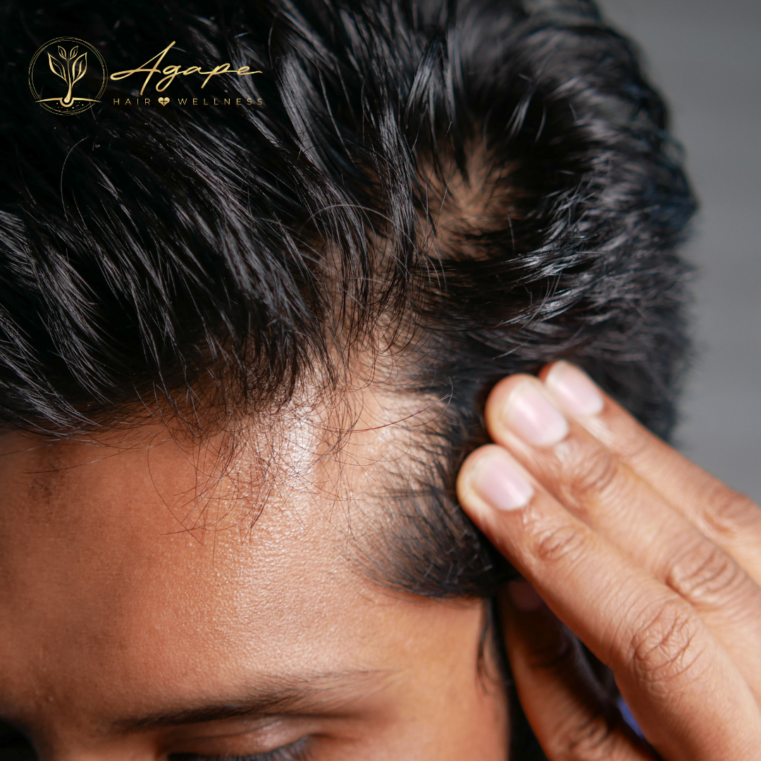 A close up of a man 's head with a hand on it