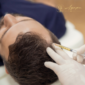 A man with a beard is getting an injection in his hair