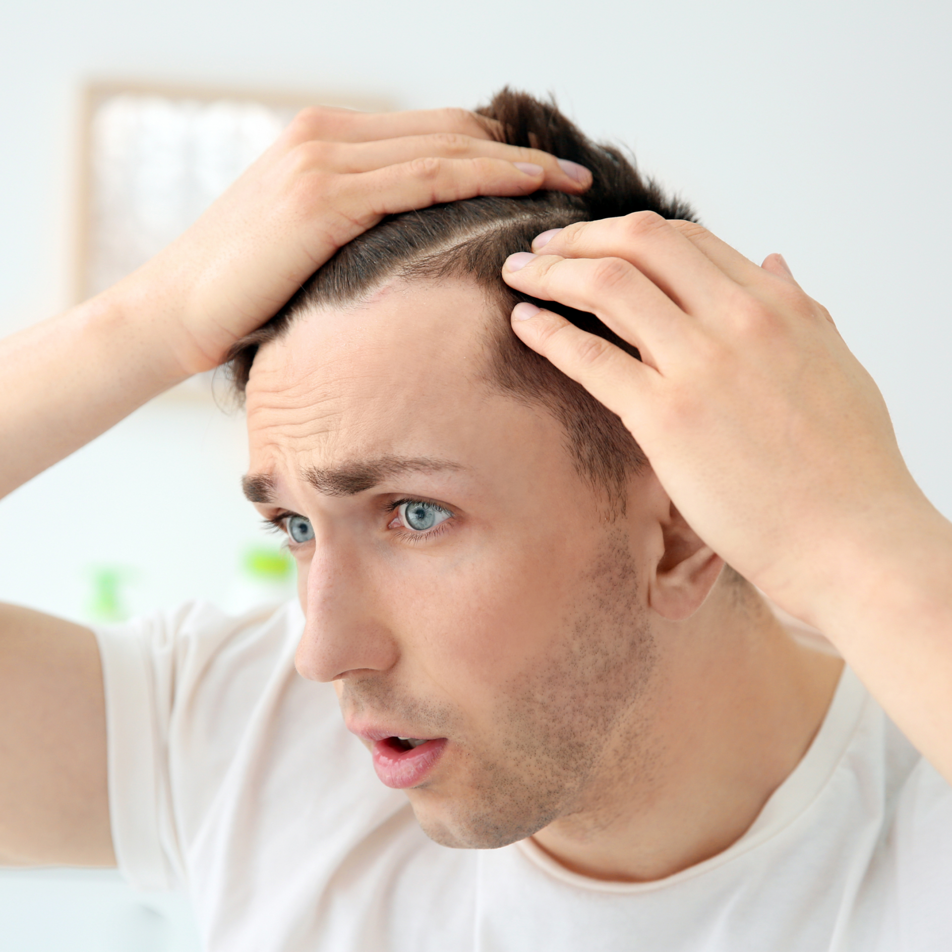 A man in a white shirt is holding his head and looking at his hair.