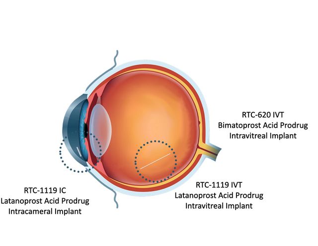 Ripple Therapeutics