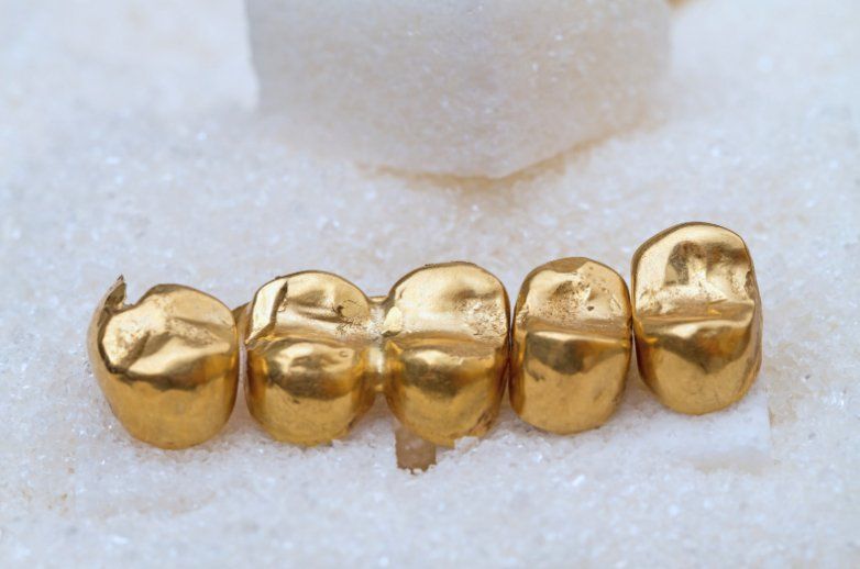 gold crowns for dental procedure. Kipnis Dental Implant Clinic in Brooklyn is the premier dentistry