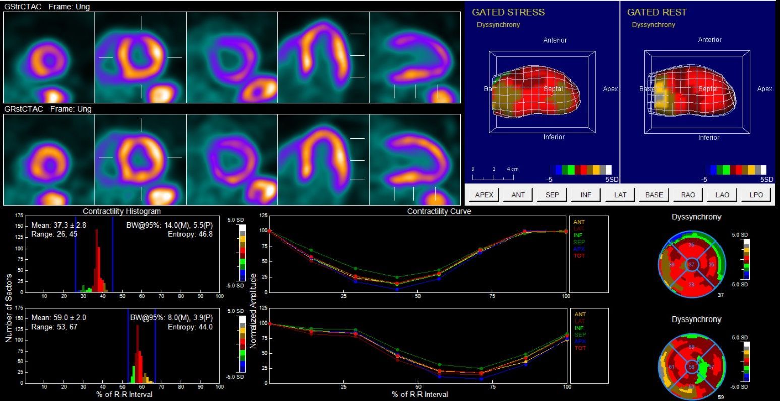 san+luis+obispo+heart+doctor MEDICALtechnology