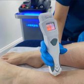 A practitioner in blue gloves uses a handheld laser device on a patient's lower leg in a clinical treatment room.