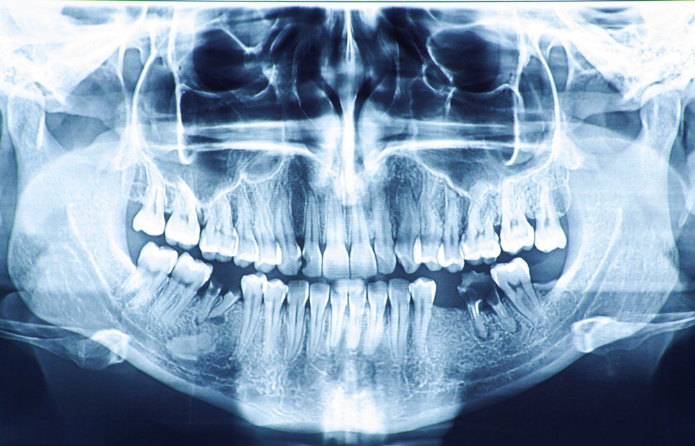 Dental Exams — High Resolution Panoramic Dental Radiography in Clinton, MS