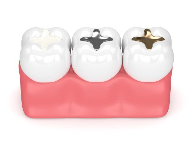 Dental X-Rays — Teeth Fillings in Clinton, MS