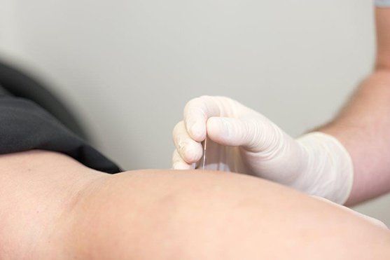 Hand putting a needle in  legs