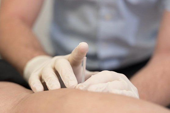 Hand putting a needle in  legs