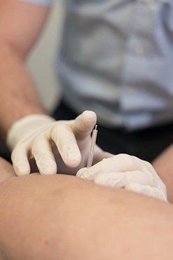 Hand putting a needle in  legs