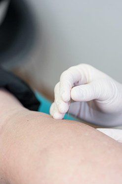 Hand putting a needle in  legs